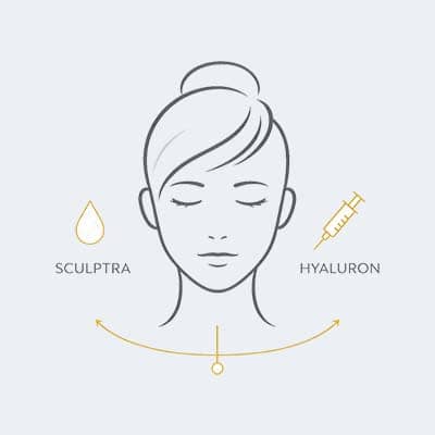 sculptra-behandlung-sculptra-hyaluron-03
