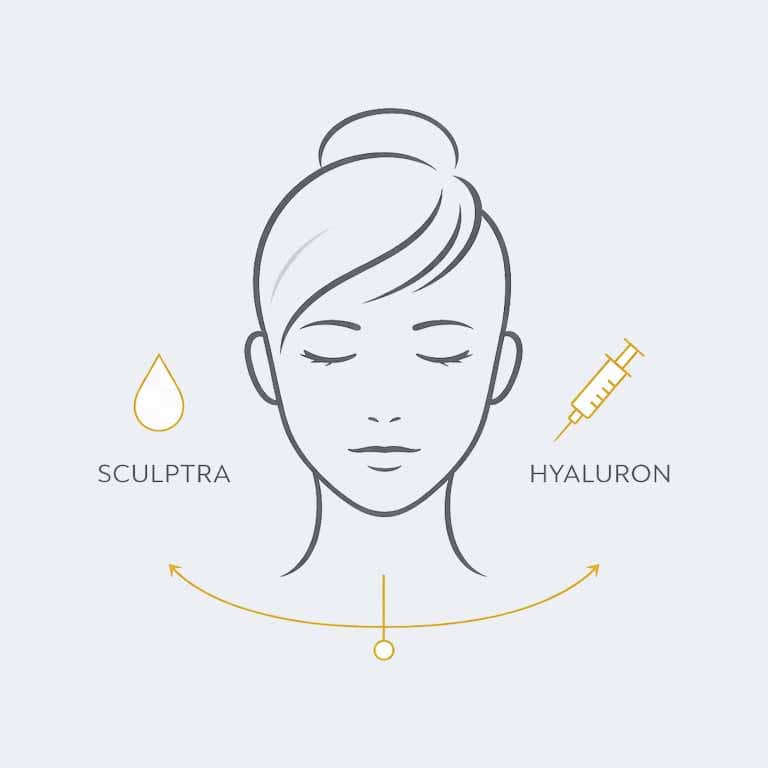 sculptra-behandlung-sculptra-hyaluron-03