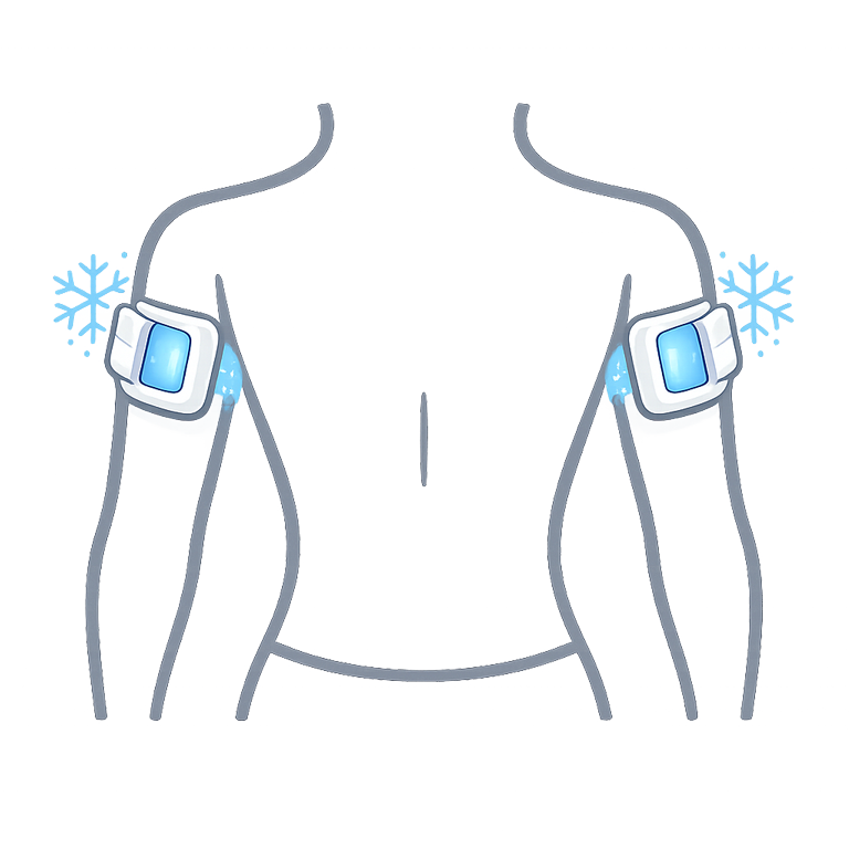 Medizinische Kryolipolyse an den Oberarmen