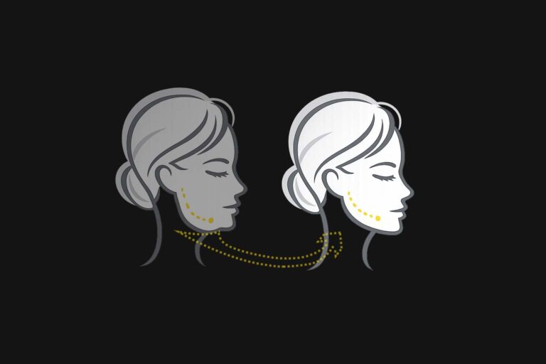 Hängebäckchen - Ursachen und hochwirksame Behandlungen